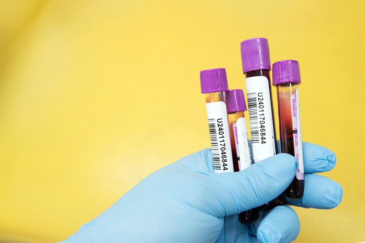 Clinical laboratory blood test tubes